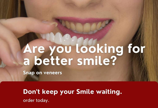 snap-on veneers