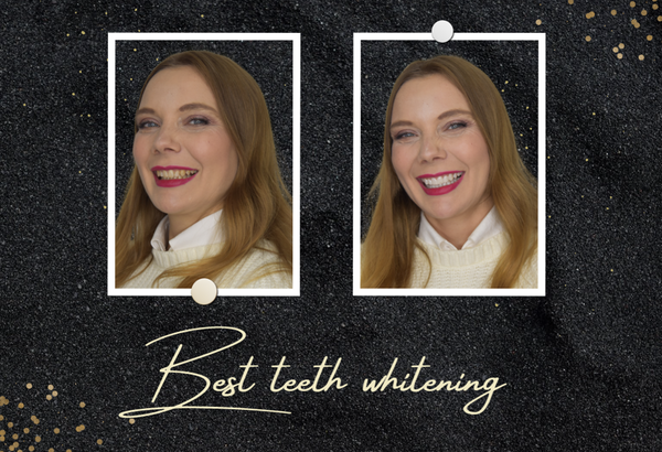 Best teeth whitening