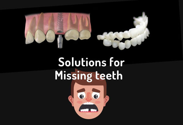 Snap on veneers can be a strong alternative for dental implants & missing teeth