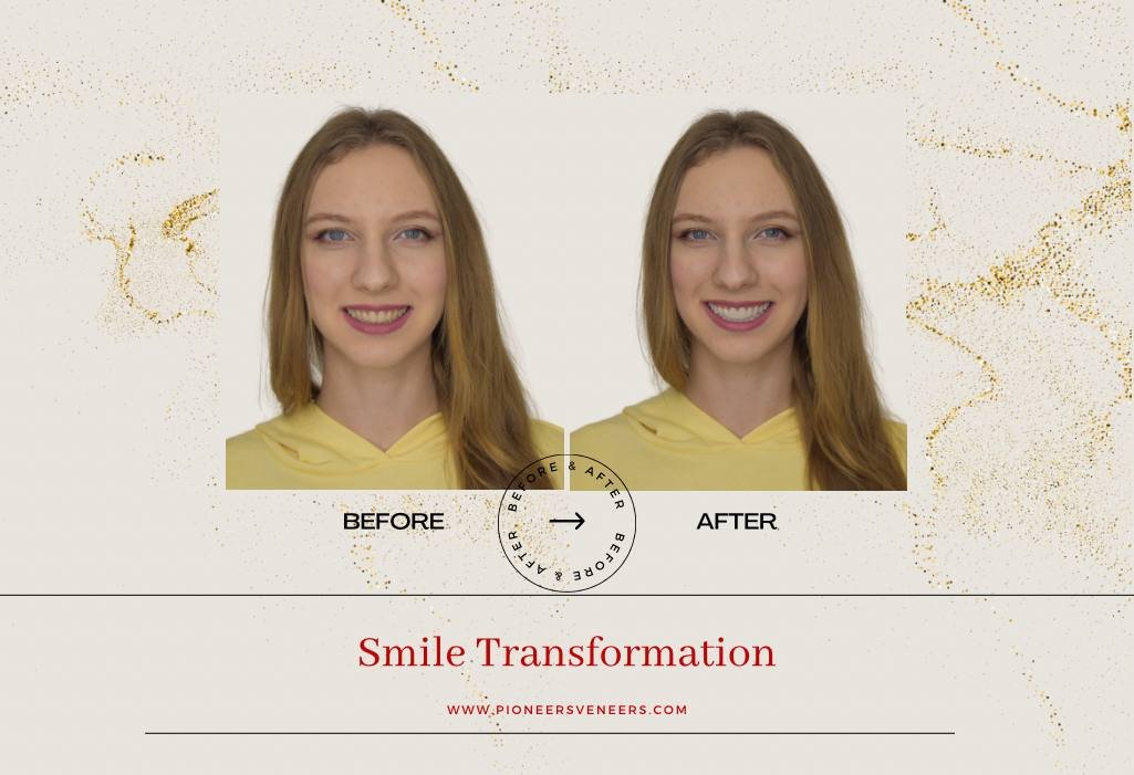 before and after snap on