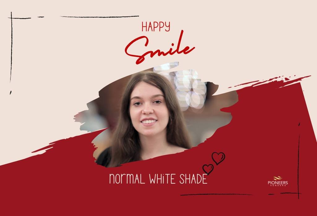 best way to whiten teeth