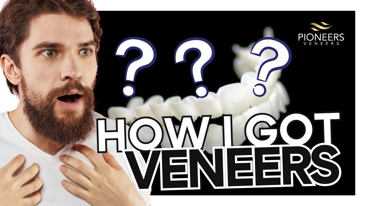 Best Snap On Veneers Lisp: My First-hand Experience