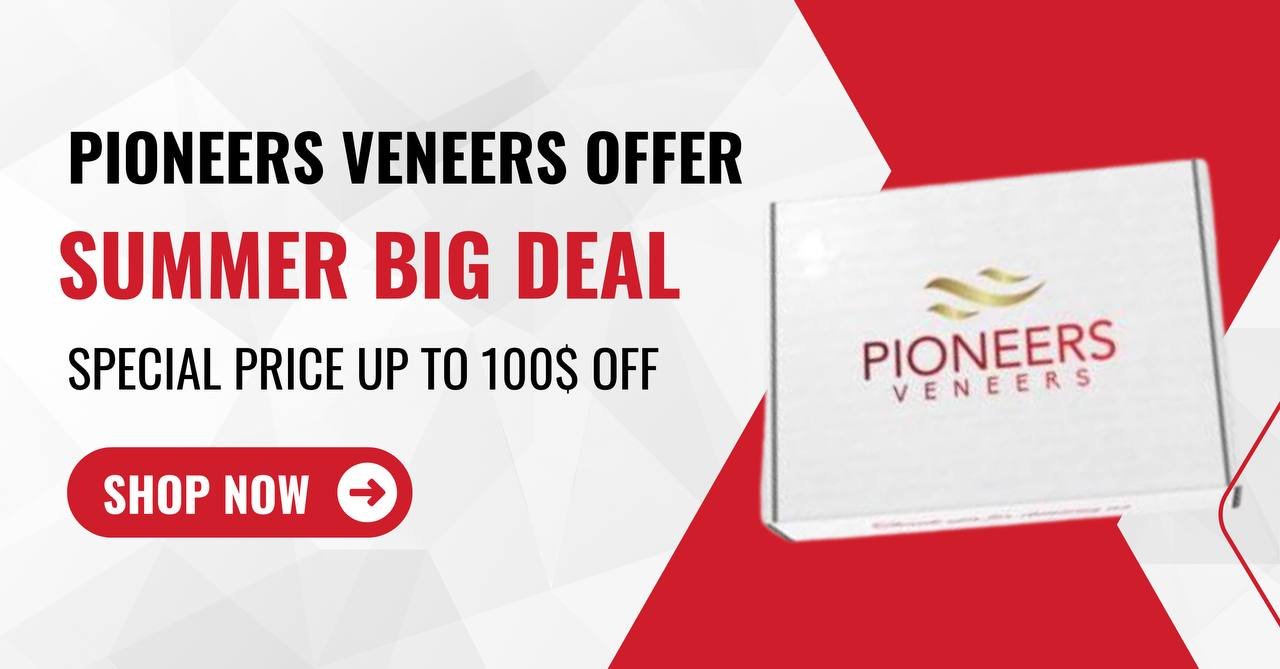 Snap-on veneers