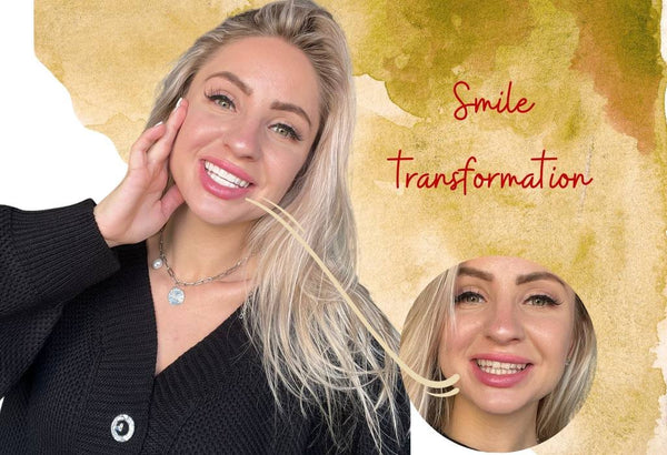smile transformation
