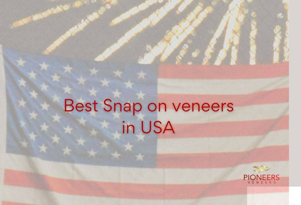 snap on veneers