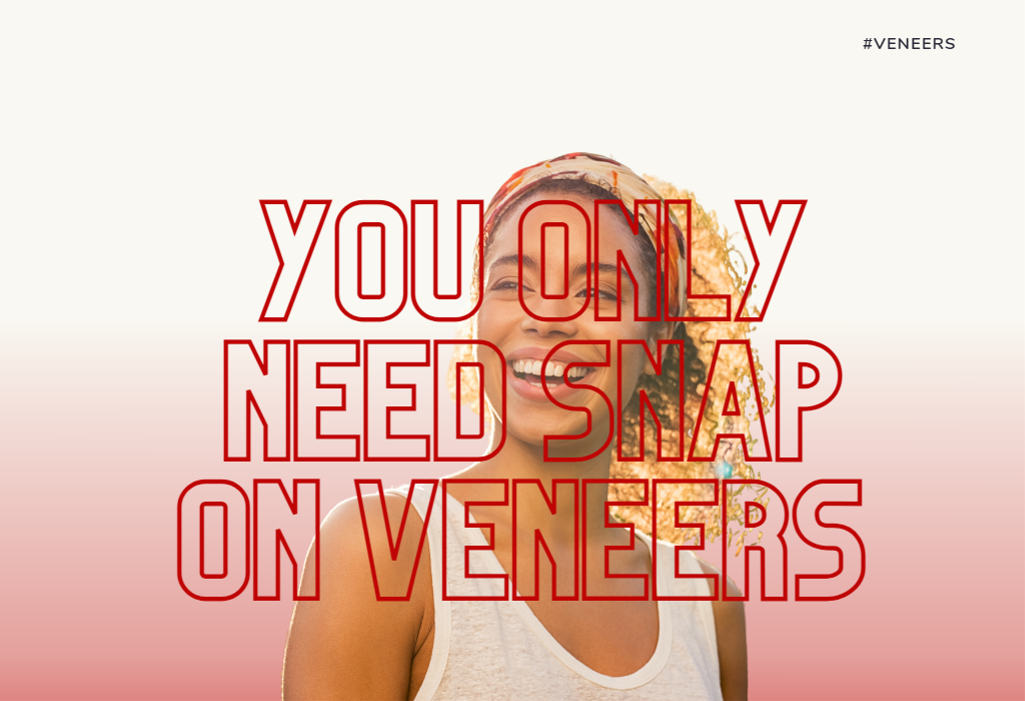 You only need snap on veneers