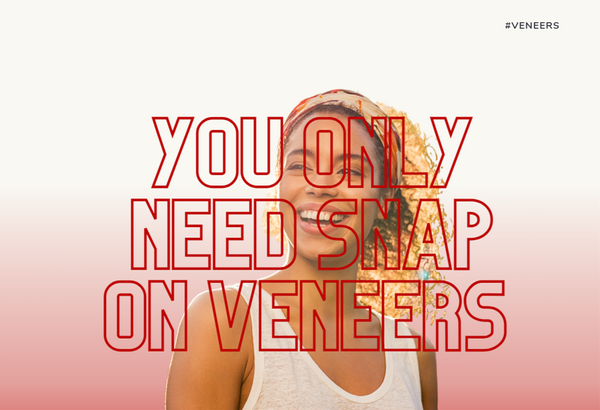 You only need snap on veneers