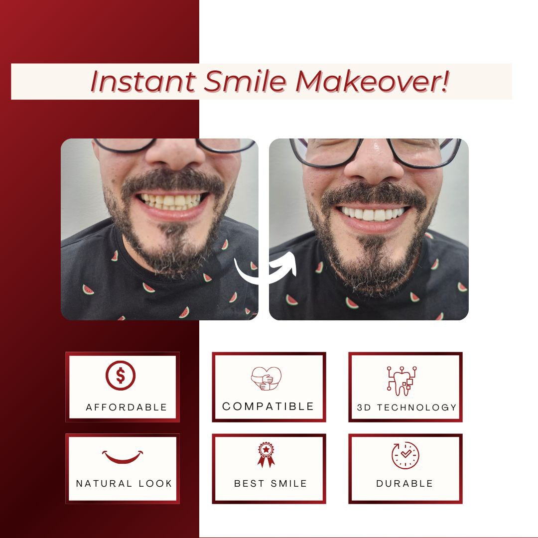 Pioneers Veneers Custom Clip on Veneers (Top, Bottom, or Full Set)