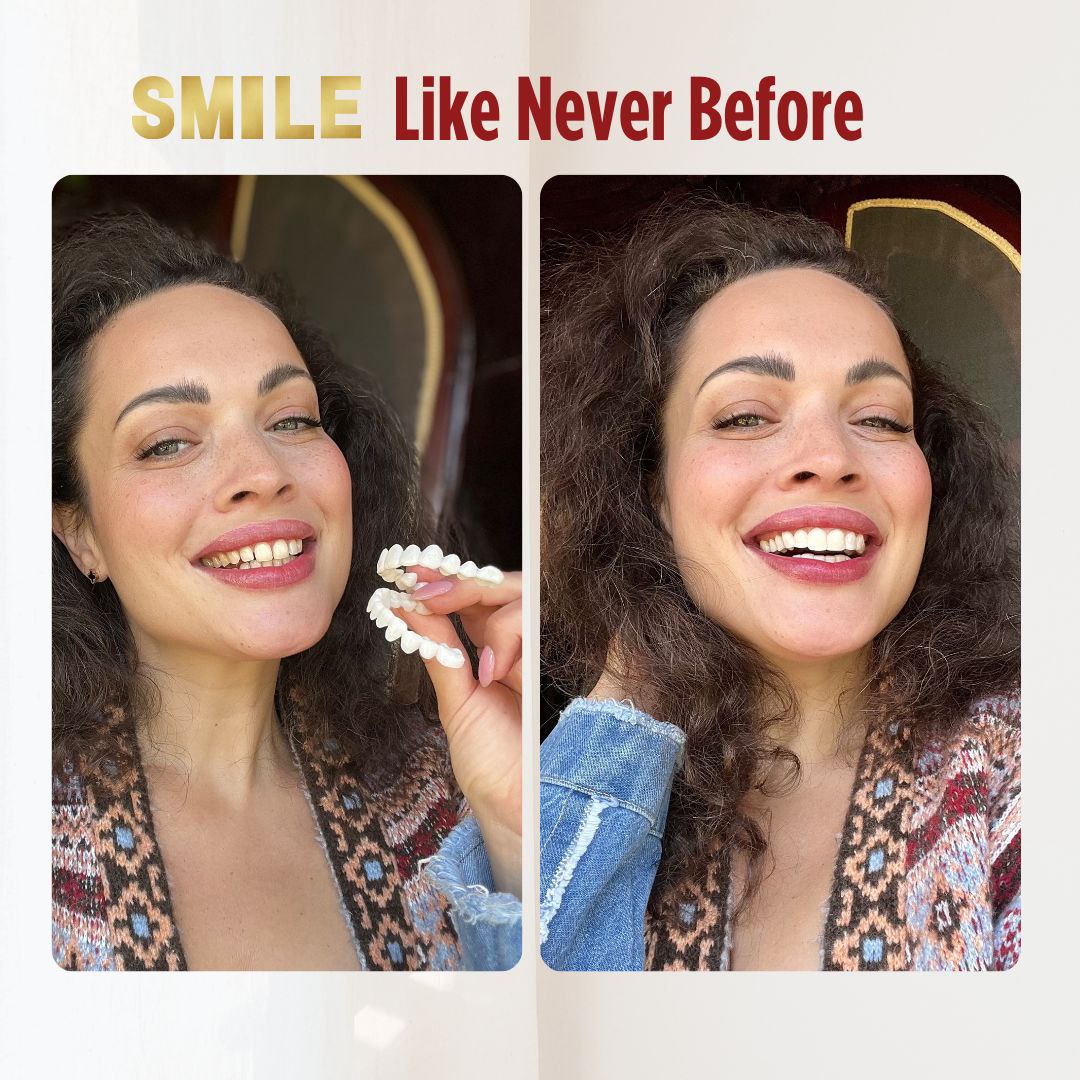 Pioneers Veneers Custom Clip on Veneers (Top, Bottom, or Full Set)